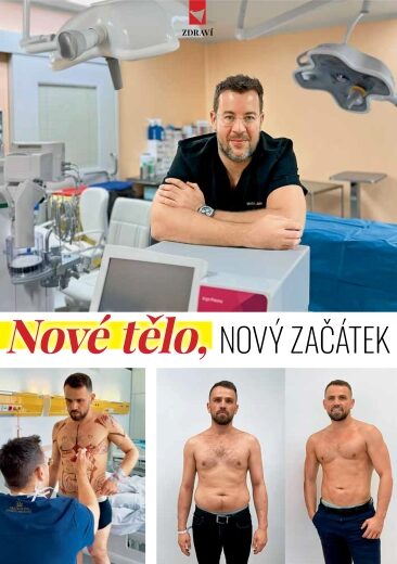 01a_hi-def_liposukce_aesthevita_jan_pilka kopie