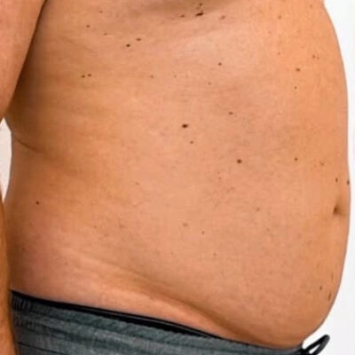 02_hi-def_aesthevita_pilka (1)