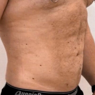 02_hi-def_aesthevita_pilka (2)