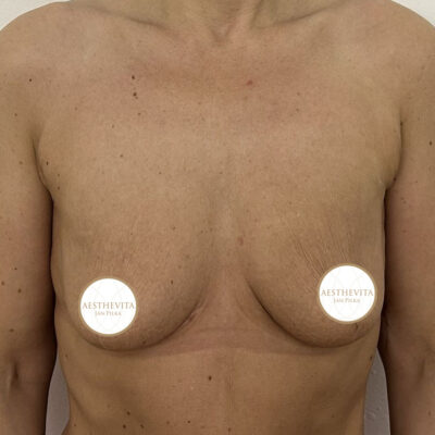 mia-femtech-003-pred