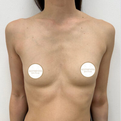 mia-femtech-005-pred