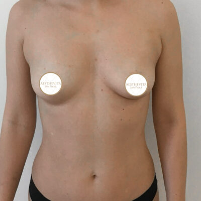 mia-femtech-010-pred