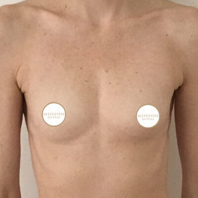 mia-femtech-011-pred