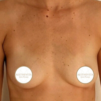 mia-femtech-012-pred