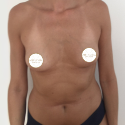 mia-femtech-013-pred