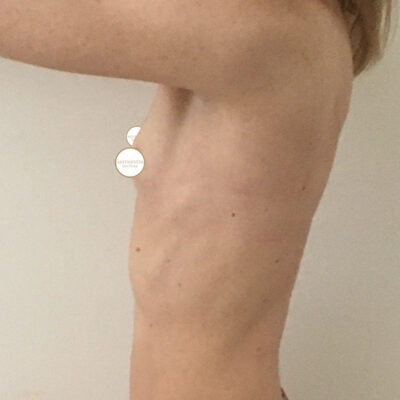 mia-femtech-015-pred