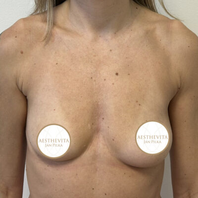 mia-femtech-020-pred