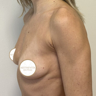 mia-femtech-021-pred