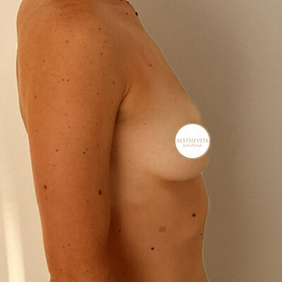 mia-femtech-024-pred