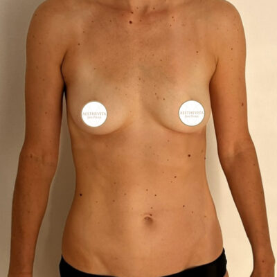 mia-femtech-025-pred