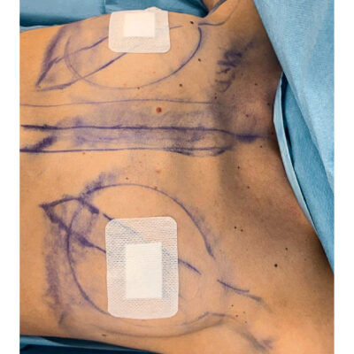 mia-femtech-028-pred