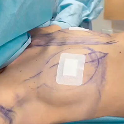 mia-femtech-030-pred