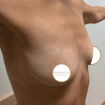 mia-femtech-031-pred