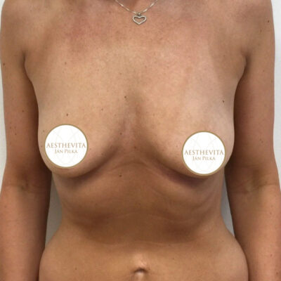 mia-femtech-032-pred