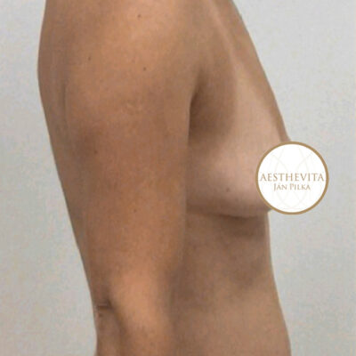 mia-femtech-034-pred