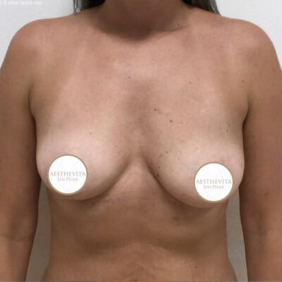 mia-femtech-035-pred