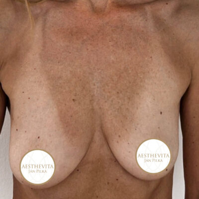 mia-femtech-036-pred (1)