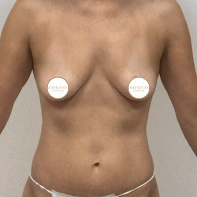 mia-femtech-037-pred