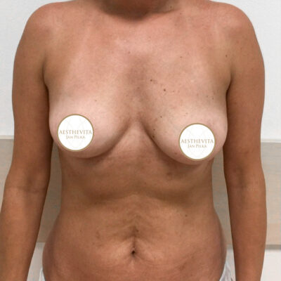 mia-femtech-038-pred