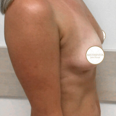 mia-femtech-041-pred