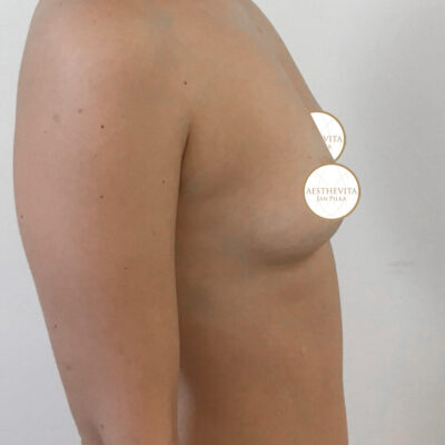 mia-femtech-042-pred