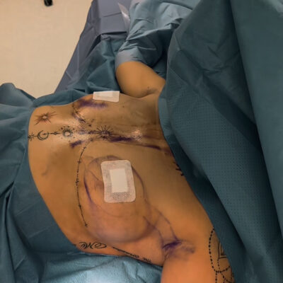 mia-femtech-045-pred