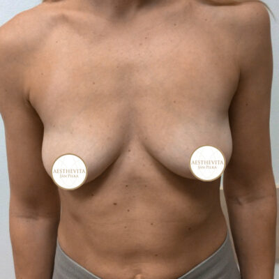 mia-femtech-049-pred