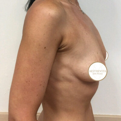 mia-femtech-050-pred