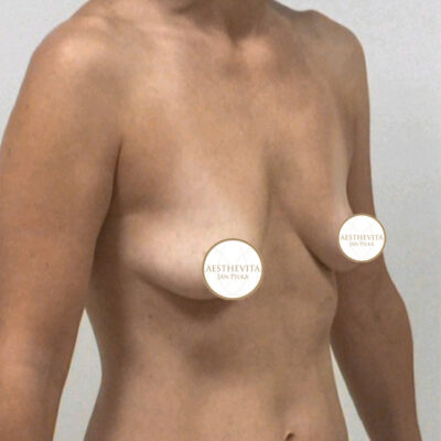 mia-femtech-051-pred