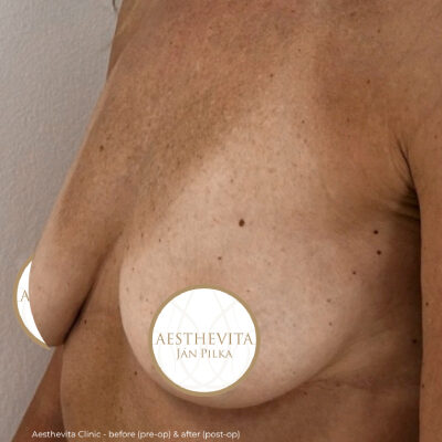 mia-femtech-052-pred (1)