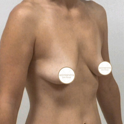 mia-femtech-053-pred