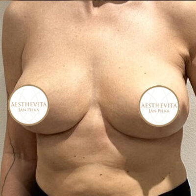 modelace-prsou-10-po (1)