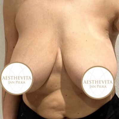 modelace-prsou-10-pred (1)