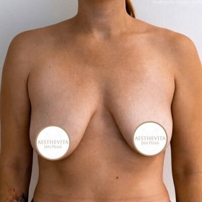 modelace-prsou-5-pred