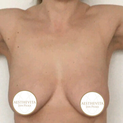 modelace-prsou-6-pred