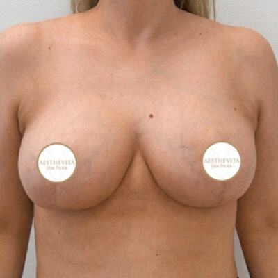 20b_modelace_prsou_aesthevita_pilka-po