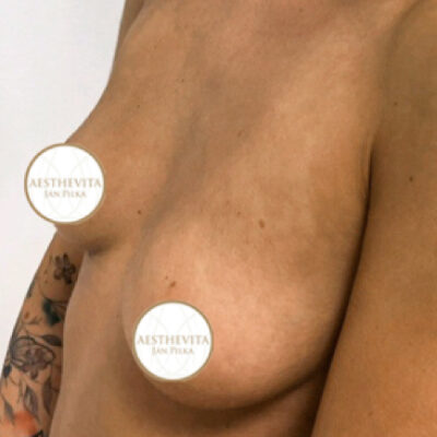 28a_mia_femtech_aesthevita_pilka-pred