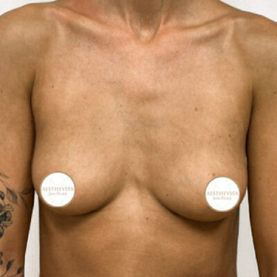 29a_mia_femtech_aesthevita_pilka-pred