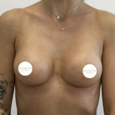 29b_mia_femtech_aesthevita_pilka-po