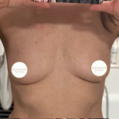 31a_mia_femtech_aesthevita_pilka-pred