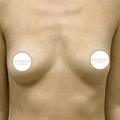 mia-femtech-058-pred