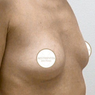 mia-femtech-059-pred