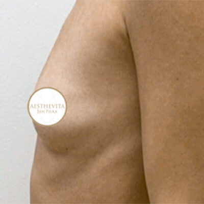 mia-femtech-060-pred