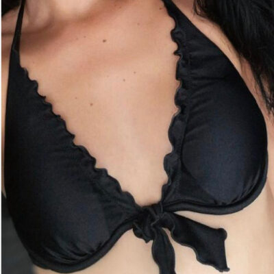 zvetseni-prsou-implantaty-28-pred