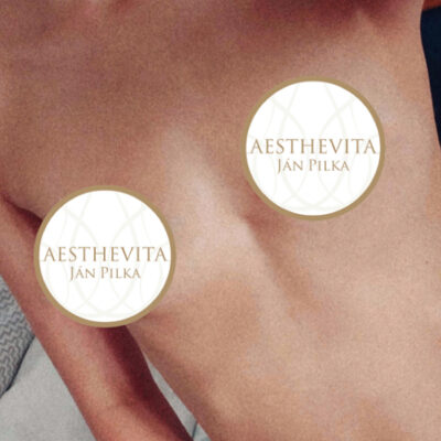 zvetseni-prsou-implantaty-32-pred