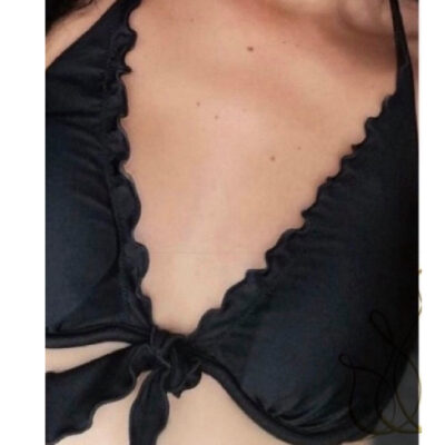 zvetseni-prsou-implantaty-7-pred