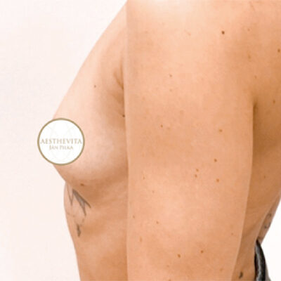 mia-femtech-061-pred