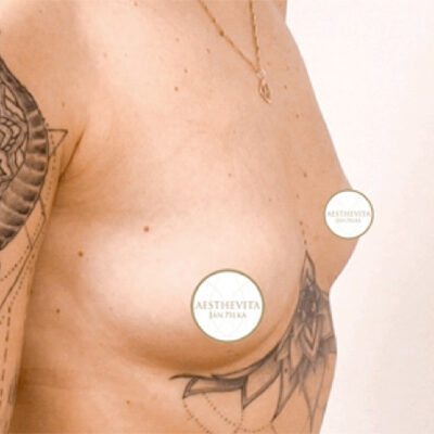 mia-femtech-062-pred