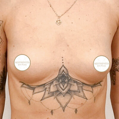 mia-femtech-063-pred